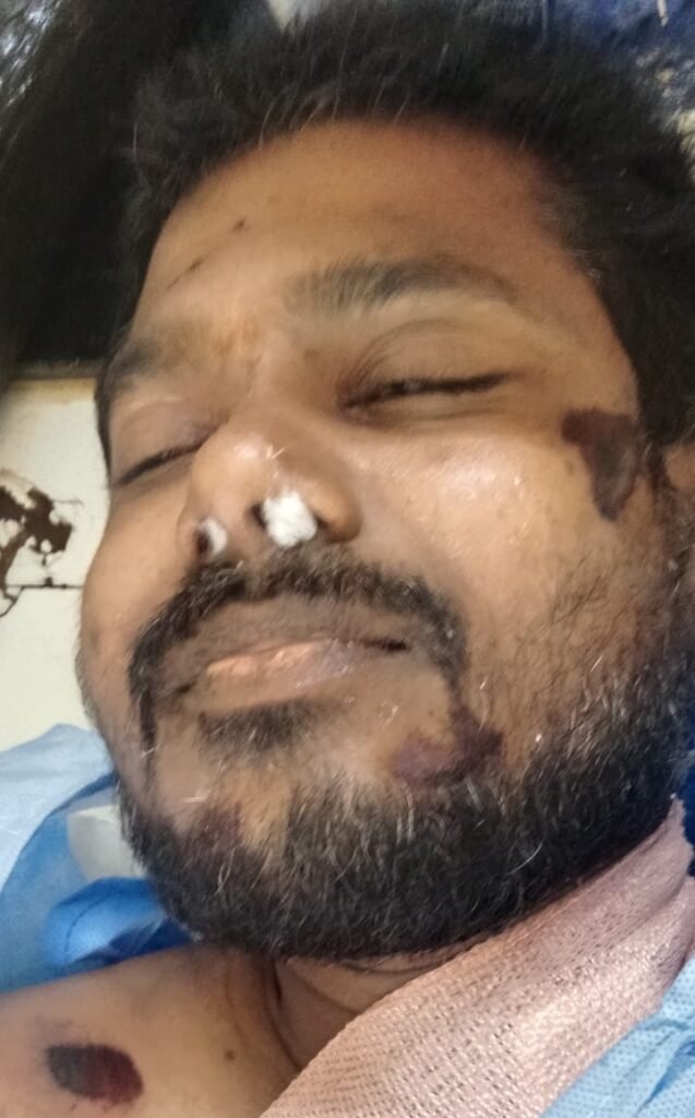 రోడ్డుపై అడవి పందులు.. బైకర్‌ మృతి